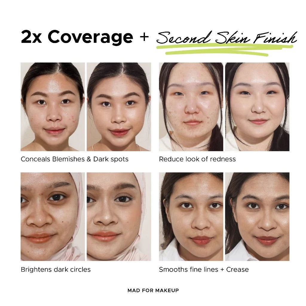 [NEW APPLICATOR] Spotless+ DreamTec UV Filter Acne Concealer